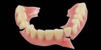 Broken denture needing repair